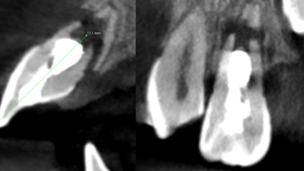 Case 1